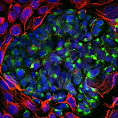 Immunoflourescence of mixed fibroblasts and PC12 cells labeled with anti-peripherin green, 1:5000) and anti-vimentin (red). The blue is DAPI staining nuclear DNA. Peripherin is labeled in only the PC12 cells cytoplasmic filaments and vimentin is only labeled in the fibroblasts intermediate filaments where peripherin is not present.
