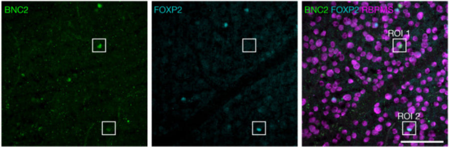 Representative confocal image of macaque GCL immunolabelled for BNC2, FOXP2 and RBPMS). Image from publication CC-BY-4.0. PMID: 37880369