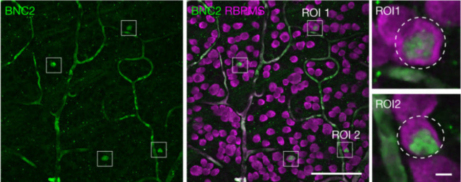 Human ganglion cell layer (GCL) labelled for BNC2 and RBPMS) with example RGC11 cells in ROIs. ROI 1 and ROI 2 are shown enlarged on the right. Images in b were 2D median filtered before maximal z-projection of the GCL. Image from publication CC-BY-4.0. PMID: 37880369