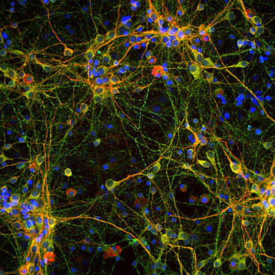 Immunostaining of cultured E20 rat cortical neurons and glia stained with anti-TAU antibody green, 1:2000) and anti-MAP2 (red). The blue is DAPI staining nuclear DNA. Anti-TAU labels perikarya, dendrites, axons of neurons while anti-MAP2 only labels dendrites and perikarya of neurons. Where they overlap they appear orange-yellow.