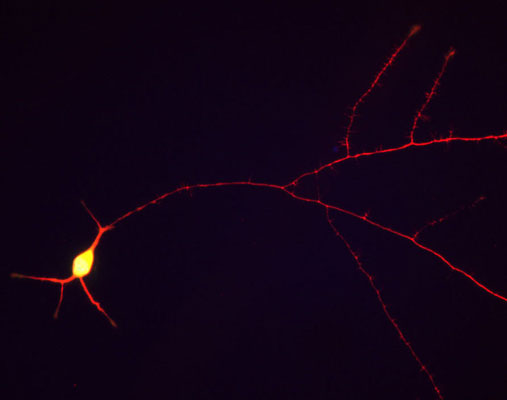 Immunostaining of cultured rat hippocampal neurons stained with anti-TAU antibody red, 1:1000) along the neuronal processes.