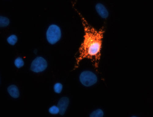 Immunofluoresence of FLAG-tagged TREM2 transfected COS cells showing TREM2 1:150) staining in red and FLAG staining in green causing positive transfected cells to appear yellow. DNA is stained blue with DAPI.