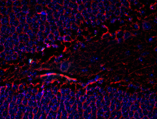 Immunostaining of mouse dentate gyrus showing beta III tubulin (red, 1:1000). The blue is staining nuclei. Photo courtesy of Robert Wine.