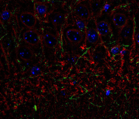 Immunolabelling of the CA3 subfield of mouse hippocampus labeling β-III tubulin 1:1000, red) and CNP green, 1:500). The blue is DAPI staining DNA. Photo courtesy of Rob Wine.