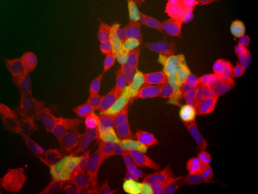 Immunolabeling of HEK 293 cells labeled with anti-UCHL1 antibody green, 1:500) and anti-neuron specific enolase antibody red, 1:500). The blue is staining nuclear DNA.