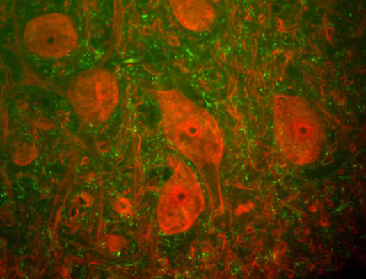 Immunofluorescence of a section of rat spinal cord labeled with anti-UCHL1 1:500, red) and anti-Neurofilament H 1:25,000, green). The large cells are alpha-motorneurons and UCHL1 fills the cytoplasm of their perikarya and dendrites.
