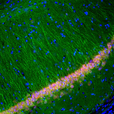 Immunofluorescence of a section of rat hippocampus showing specific labeling of UCHL1 1:5000, green) in cell bodies and dendrites of neurons, and specific labeling of FOX3 (red). The blue is DAPI staining of nuclear DNA.