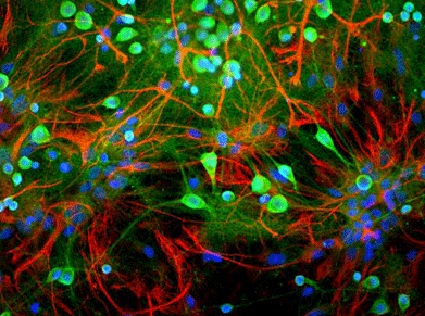 Immunostaining of mixed neuron/glial cultures stained with anti-UCHL1 antibody green, 1:500) and rabbit anti-GFAP antibody red, 1:1000). The blue stains nuclear DNA. The anti-UCHL1 stains strongly the cell body and dendrites of neurons, while anti-GFAP specifically labels astrocytes.