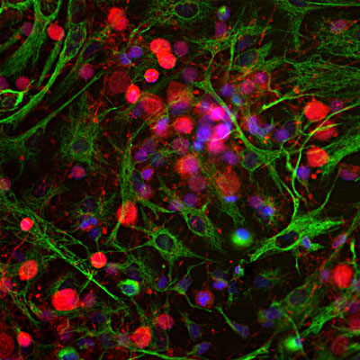 Immunostaining of E20 rat cortical neuron and glial culture stained with anti-UCHL1 antibody red, 1:500) and rabbit anti-vimentin antibody (green). The blue is DAPI staining nuclear DNA. The anti-UCHL1 stains strongly the cell body and dendrites of neurons, while anti-vimentin specifically stains intermediate filaments in fibroblasts and glia cells.