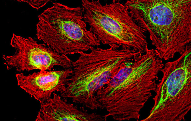 Immunostaining of HeLa cells labelled with anti-vimentin antibody 1:10,000, green), anti-actin (red), and DAPI (blue) labelling of nuclear DNA. The vimentin antibody labels the intermediate filament network while the actin antibody labels the submembranous cytoskeleton, stress fibers, and bundles of actin associated with cell adhesion sites.
