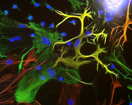 Immunostaining of mixed neuron/glial cultures stained with anti-Vimentin antibody 1:500, green) and anti-GFAP antibody 1:1000, red). Vimentin is expressed alone in fibroblastic and endothelial cells, which are the flattened cells in the middle of the image which appear green. Astrocytes may express primarily GFAP, or GFAP and vimentin, and so appear red (GFAP only) or golden yellow (GFAP and Vimentin).