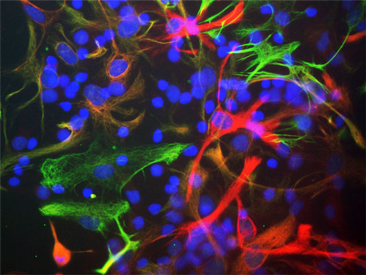 Immunostaining of cultured neonatal rat neurons and glia stained with anti-nestin antibody red, 1:500) and anti-vimentin antibody green, 1:500). The blue is Hoechst staining for nuclear DNA. Astrocytes and neuronal stem cells stain strongly and specifically in a clearly filamentous fashion with the anti-Nestin antibody. The presence of Nestin indicates that the cells are developing astrocytes, neuroblasts or undifferentiated neural stem cells.