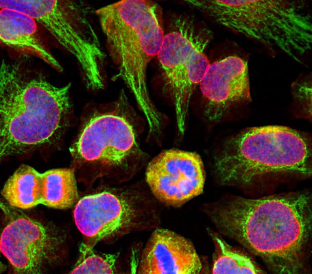 Immunolabeling of HeLa cells stained with anti-nuclear pore complex antibody red, 1:100) and rabbit anti-vimentin antibody green, 1:10,000). The blue is DAPI staining nuclear DNA. The anti-nuclear pore complex antibody reveals strong granular labeling of the nuclei corresponding to the protein. The anti-vimentin antibody specifically labels intermediate filaments.