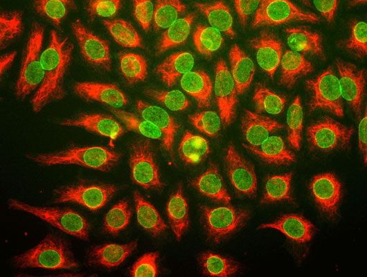 Immunostaining of HeLa cells stained with anti-nuclear pore complex antibody green, 1:100) and rabbit anti-vimentin antibody red, 1:500).