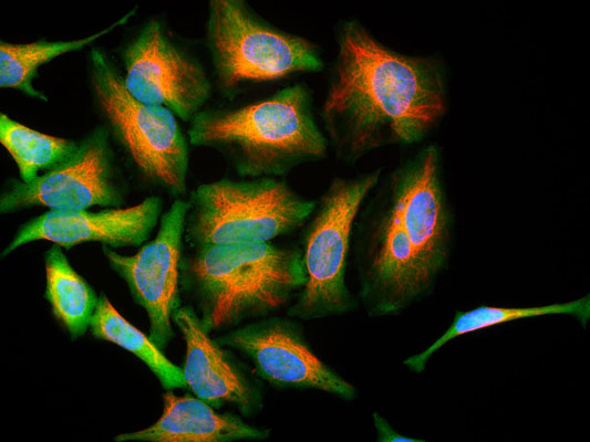 Immunoflourescence of HeLa cells stained with Anti-Park7 green, 1:1000) showing strong cytoplasmic staining and Anti-Vimentin red, 1:10,000) labeling cytoplasmic intermediate filaments. The blue is nuclear staining.
