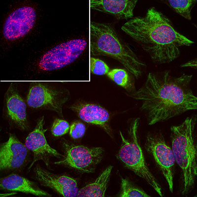 Immunoflourescence of HeLa cells labeled with anti-SAP49 red, 1:1000) and anti-vimentin green, 1:10,000). The blue is DAPI staining nuclear DNA.