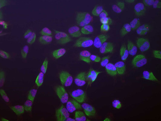 Immunofluorescence of HeLa cells showing strong granular nuclear staining of SAP49 (red, 1:1000) and vimentin green, 1:10,000). The blue is DAPI staining nuclear DNA.