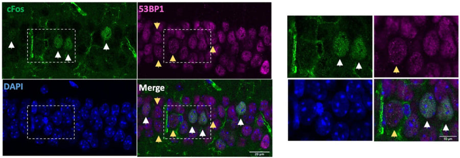 Representative images of CA1 region of mouse hippocampus. White arrows indicate cFos+ cells), yellow arrows indicate 53BP1 + cells. Nuclei stained with DAPI (blue). Right: zoomed images of the white boxes. Image from publication CC-BY-4.0. PMID: 36732588
