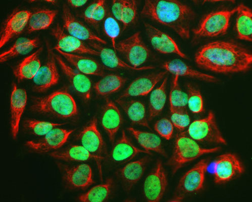 Immunofluorescence of serum starved, FBS stimulated HeLa cells showing nuclear labeling of activated cells with Anti- c-FOS 1:1000, green) while Anti-Vimentin 1:500, red) labels the cytoplasmic intermediate filament, and nuclear staining with DAPI (blue).