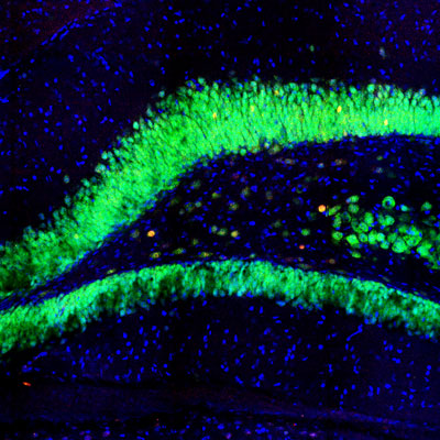 Immunofluorescence of a section of rat hippocampus showing neurons labeled with c-FOS 1:1000, red) counterstained with FOX3(NeuN) (green), and nuclear staining with DAPI. When both c-FOS and FOX3 are expressed the label appears orange.