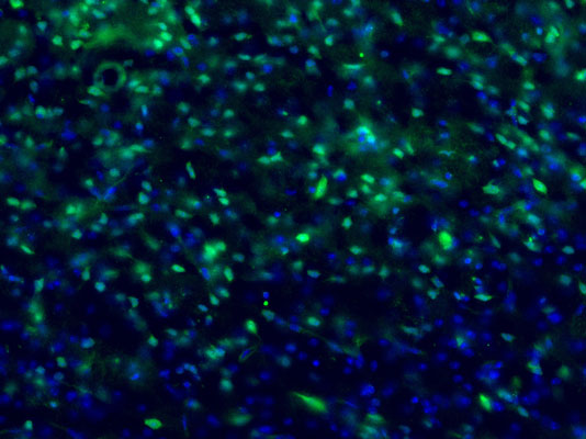 Immunostaining of mouse brain labeling c-Fos protein in green 1:1000) and DNA with DAPI. Photo courtesy of Adam Almeida, University of Colorado.