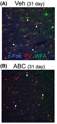 (A, B) confocal microscope images showing PV, WFA, and c-Fos) staining after vehicle or ABC treatment in the prelimbic PFC after vehicle or ABC 31 days later. White arrows indicate triple-labelled cells. Note faint staining of PNNs after ABC treatment. Image from publication CC-BY-4.0. PMID: 37855072.