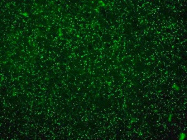 Goat Anti-ChAT (Choline Acetyltransferase)