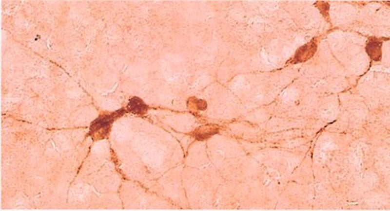 Goat Anti-ChAT (Choline Acetyltransferase)
