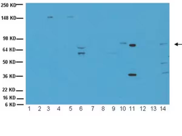 Goat Anti-ChAT (Choline Acetyltransferase)