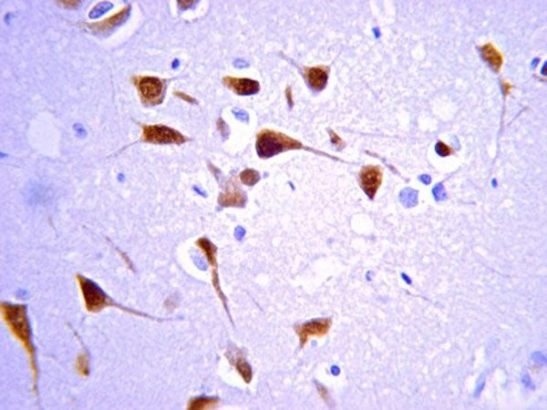 Rabbit Anti-ChAT (Choline Acetyltransferase)