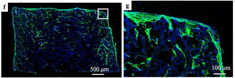 Immunolabeling of a hiPSCs seeded sponge section cultured for 28 days labeling COL1A1 1:100, green) expression and nuclei are labeled with DAPI. Image from publication, CC-BY-4.0. PMID: 39664802.
