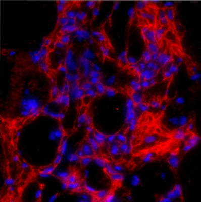Immunostaining of formaldehyde-fixed fibrotic mouse lung tissue. The antibody recognizes mature collagen I 1:100, red) that has formed fibrils in the extracellular matrix. The blue is staining nuclear DNA.