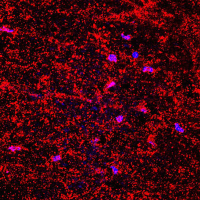 Immunofluorescence of a transversal section from mouse spinal cord labeling fibers of collagen (red, 1:200) from the tissue scaffold. The blue is DAPI counterstaining nuclear DNA. Image kindly provided by Dr. Rodolfo Gatto and Dr. Gerardo Morfini, Department of Anatomy and Cell biology, University of Illinois at Chicago.