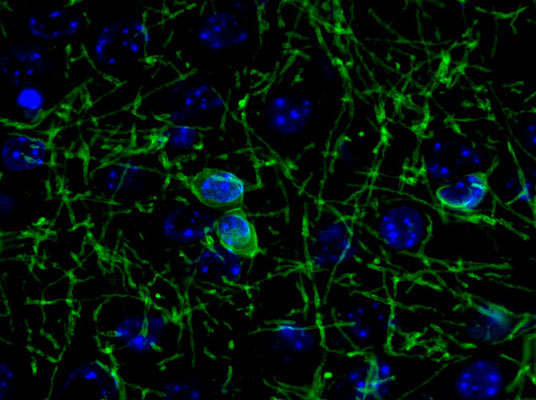 Immunochemical staining of saline treated mouse cortex cryosections showing specific labeling of CNP green, 1:500). The blue is staining DNA. The bisected longitudinal mouse brain was fixed for 18h in 4% paraformaldehyde, washed, and cryoprotected in 30% sucrose overnight. The cryosections were antigen retrieved in citrate buffer, blocked in 20% normal goat serum for 1 hr. Photo courtesy of Robert Wine.