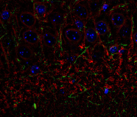 Immunolabelling of the CA3 subfield of mouse hippocampus labeling CNP green, 1:500) and β-III tubulin 1:1000, red). The blue is DAPI staining DNA. Original magnification is 40X. Photo courtesy Rob Wine.