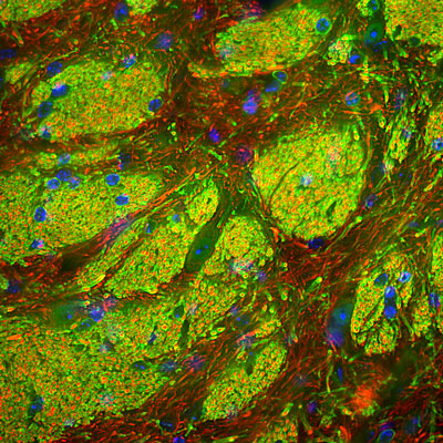 Immunostaining of mouse striatum showing specific labeling of CNP in myelinating oligodendrocytes green, 1:3000) and neurofilament L (red, 1:5000). The blue is staining DNA.