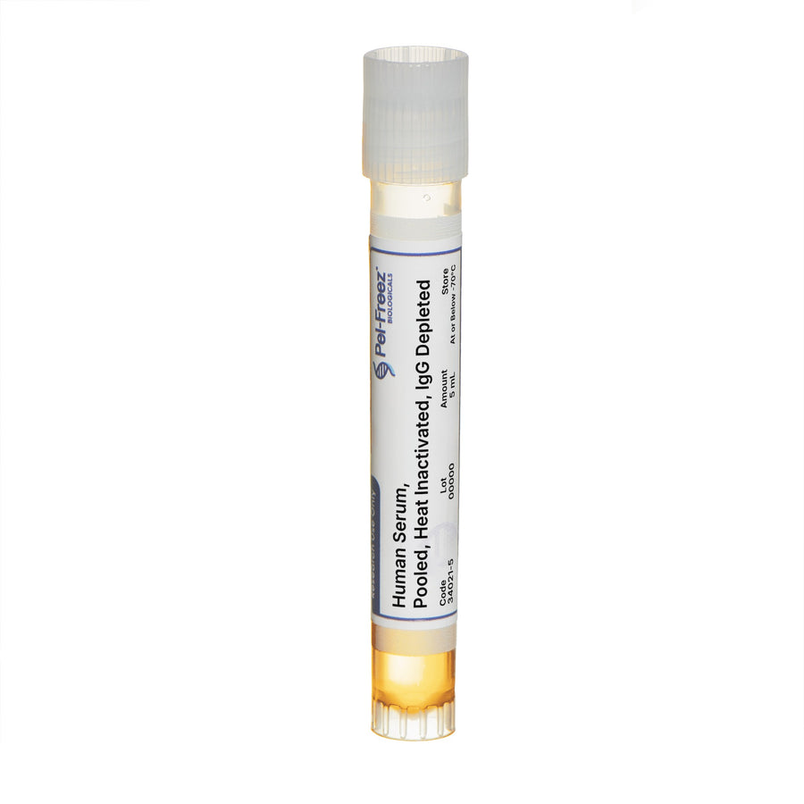 Human Serum, Pooled, Heat Inactivated, IgG Depleted