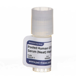 Human Serum, Pooled, Off the Clot, Heat Inactivated