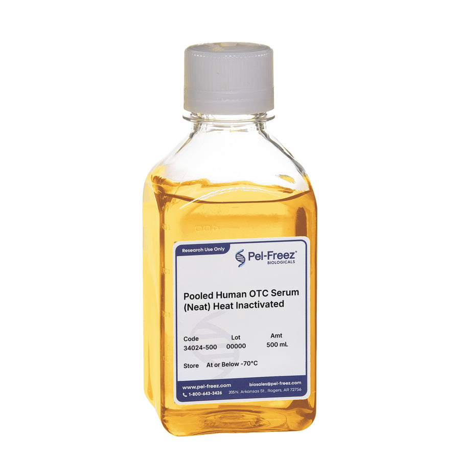 Human Serum, Pooled, Off the Clot, Heat Inactivated