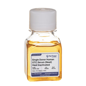 Human Serum, Single Donor, Off the Clot, Heat Inactivated