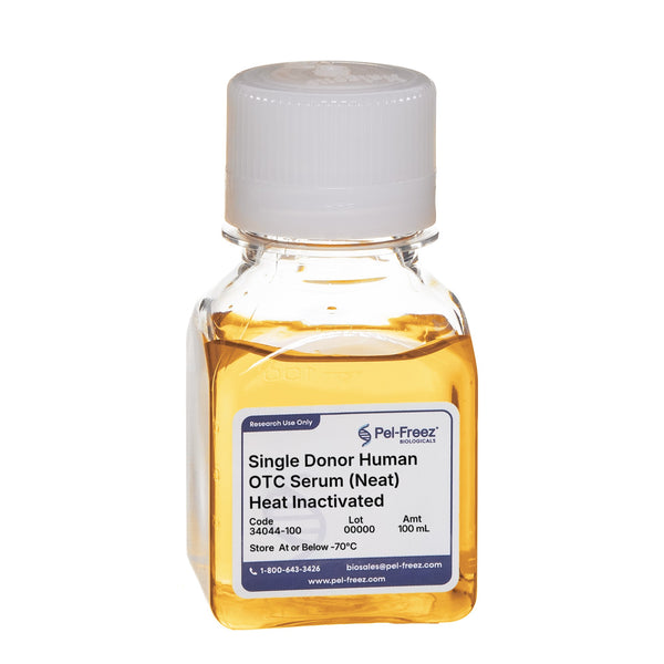 Human Serum, Single Donor, Off the Clot, Heat Inactivated