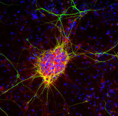 Immunofluorescence of rat cortical neuron-glial cells showing strong cytoplasmic labeling of a small population of developing neurons and their processes with Anti-DCX 1:1000, red) while Anti-MAP2 1:10,000, green) labels dendrites and perikarya or mature neurons, and additional nuclear staining was done with DAPI (blue). Anti-doublecortin is an excellent marker of early developing neuronal cells.