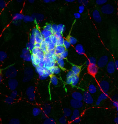 Immunofluorescence of cultured rat neurons showing strong cytoplasmic staining of doublecortin 1:1000,green) in developing neurons and GFAP 1:1000, red)
