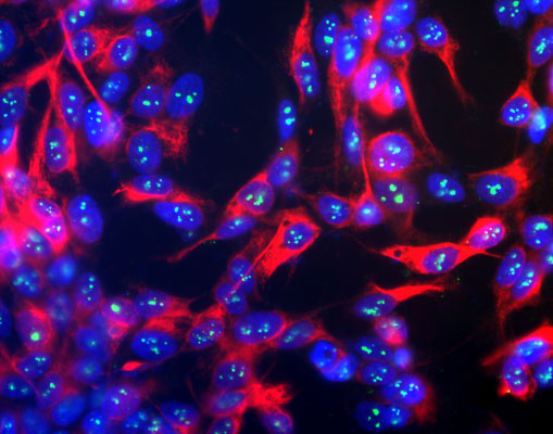 Immunofluorescence of human neuroblastoma SH-SY5Y cells showing strong, prominent labeling of the nucleoli in the nucleus with Anti-Fibrillarin 1:500, green), and nuclear staining was done with DAPI (blue) which makes the fibrillarin marker appear pale blue.