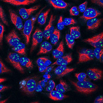High magnification confocal image of HeLa cells showing strong, prominent labeling of the nucleoli in the nucleus with Anti-Fibrillarin 1:100, green), colabeled with Anti-Vimentin red, 1:1000) showing the cytoplasmic intermediated filaments, and nuclear staining was done with DAPI (blue).