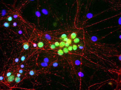Immunofluorescence of cultured rat neurons showing nuclear and distal cytoplasmic labeling of FOX1 1:500, green).
