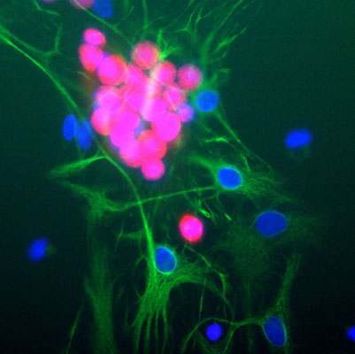 Immunolabeling of cultured rat neurons showing strong nuclear and distal cytoplasmic labeling with anti-FOX3 1:1000, red). The complete absence of astrocyte staining is shown using anti-GFAP 1:1000, green) and nuclear staining was done with DAPI (blue).