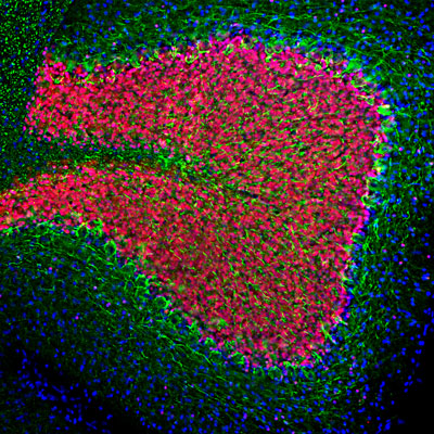 Immunofluorescence of a section of rat cerebellum showing specific labeling of Neurofilament-L 1:2000, green) and labeling of FOX3/NeuN 1:5000, red). The anti-NFL strongly labels the axons of basket calls and perikarya and processes of neuronal cells. The anti-FOX3/NeuN labels the nuclei and proximal cytoplasm of neurons. The blue is DAPI staining of nuclear DNA.