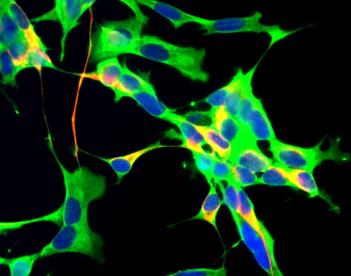 Immunostaining of Human neuroblastoma SH-SY5Y cells labeled with Anti-GAPDH 1:100, green), Anti NF-H red, 1:25,000) and nuclear staining with DAPI (blue).