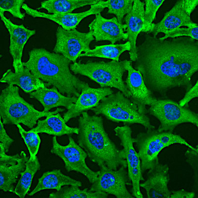 Immunostaining of HeLa cells labeled with Anti-GAPDH 1:100, green) and nuclear staining with DAPI (blue). The anti-GAPDH produces strong cytoplasmic labeling of healthy cells.